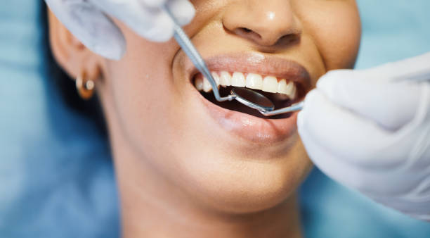 Best Emergency Tooth Extraction in Sparta, TN